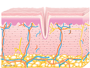 Image of Untreated Skin